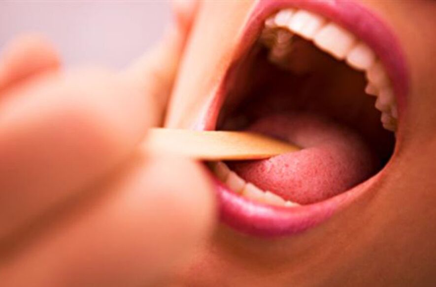 llojet e parazitëve në gojën e njeriut